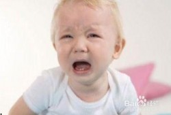 宝宝饭后吃网纹瓜吐了,警惕食物过敏与消化问题